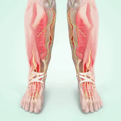 TrueNerv - EMS Foot Stimulator for Numbness, Tingling & Nerve Discomfort